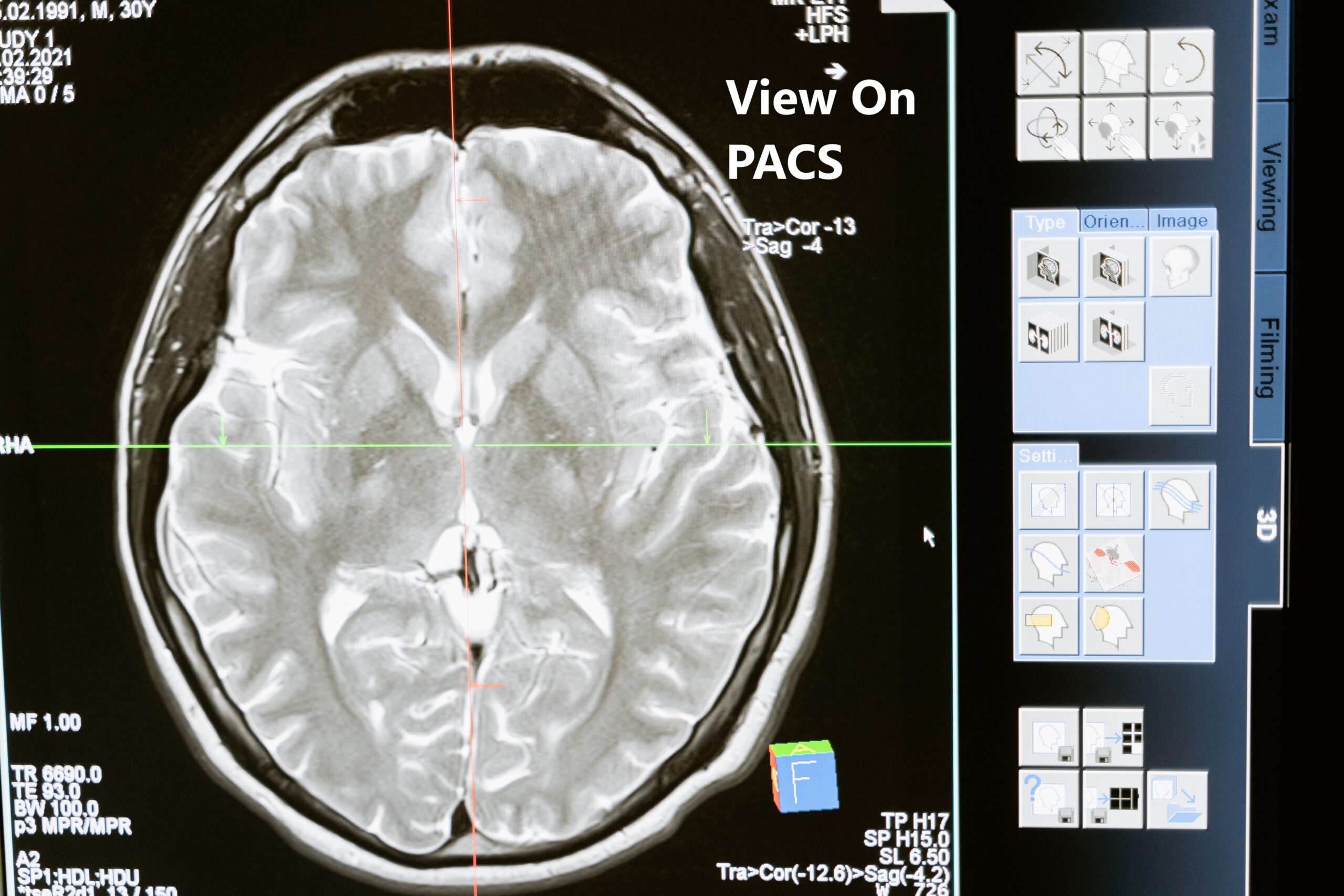 Brain scan on PACS